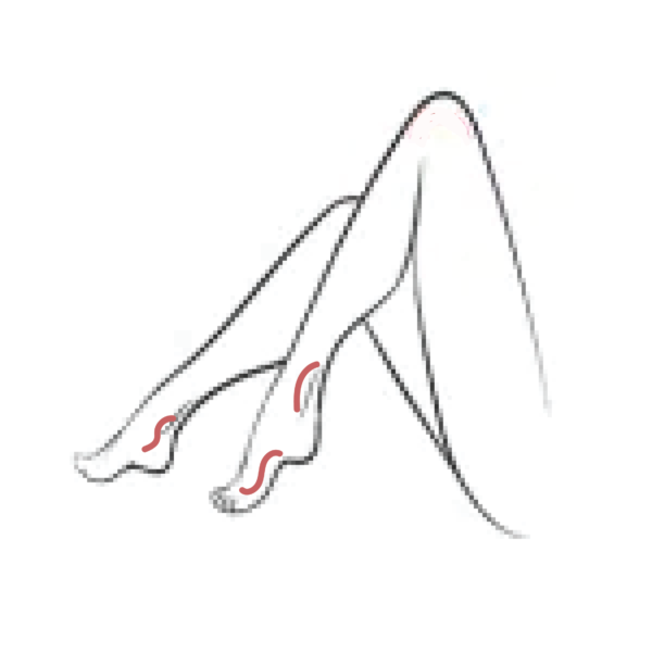 VL-FV - Ankles & Feet Veins- Single Session