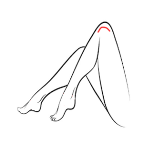 VL/ST - Knees - Package of 8