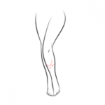VL-FV - Leg Veins Large Area - Package of 5