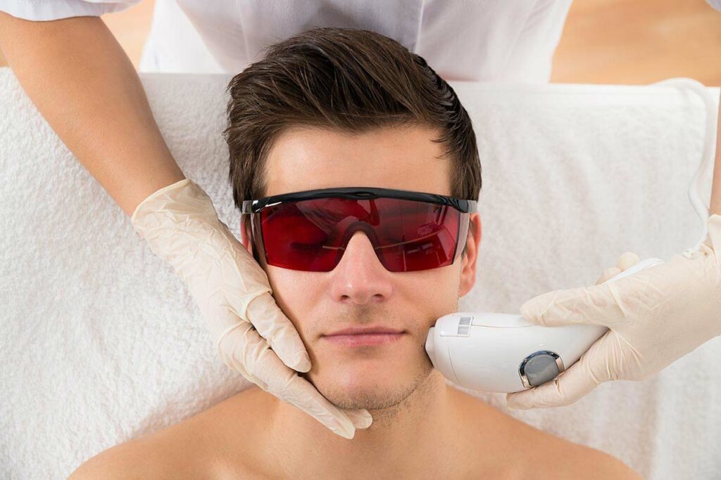 Results from Laser Hair Removal for men