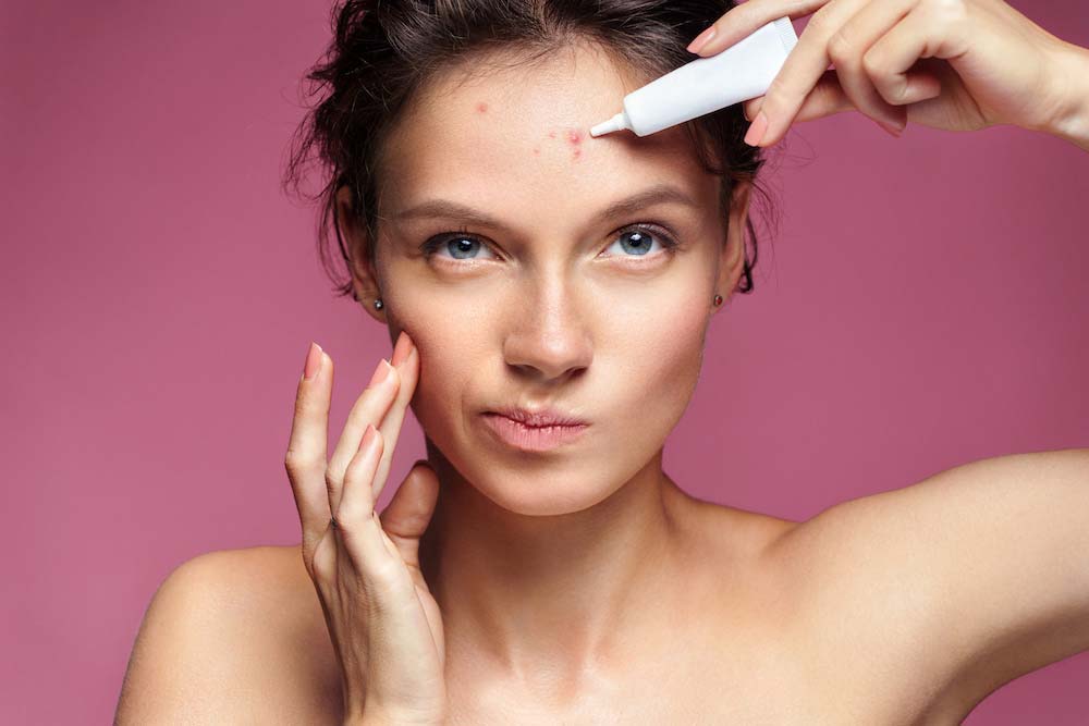 acne scars medications