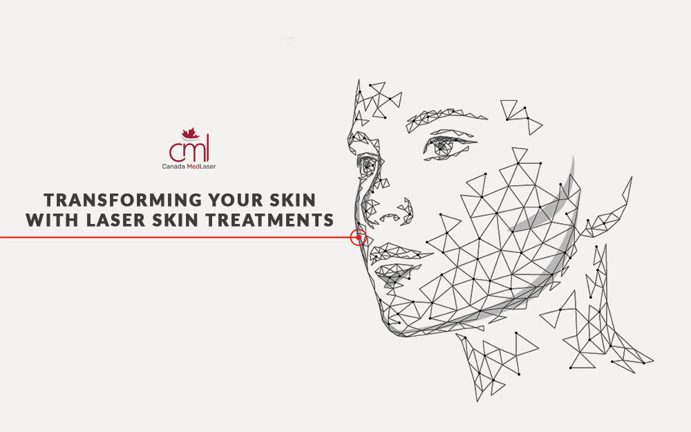 Laser Skin Resurfacing
