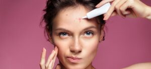 Acne and Rosacea: Know the Difference