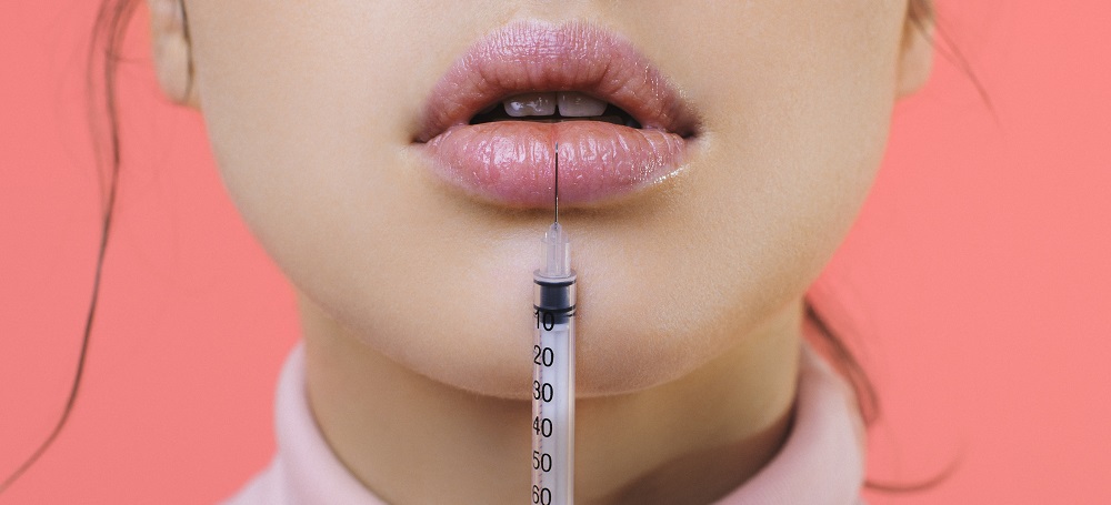 All You Need to Know About Lip Fillers