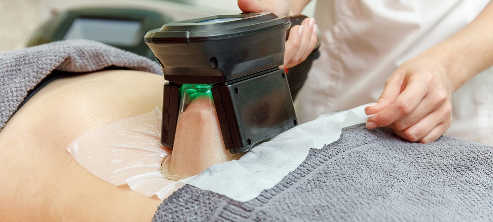How to Choose a CoolSculpting Clinic in Toronto