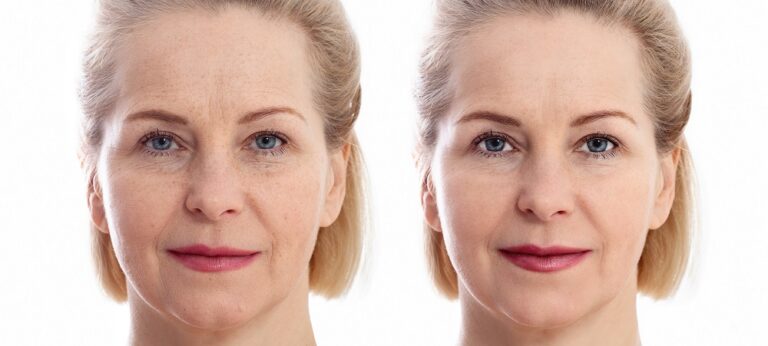 Keep your Skin Beautiful: Tips for Skin Anti-ageing