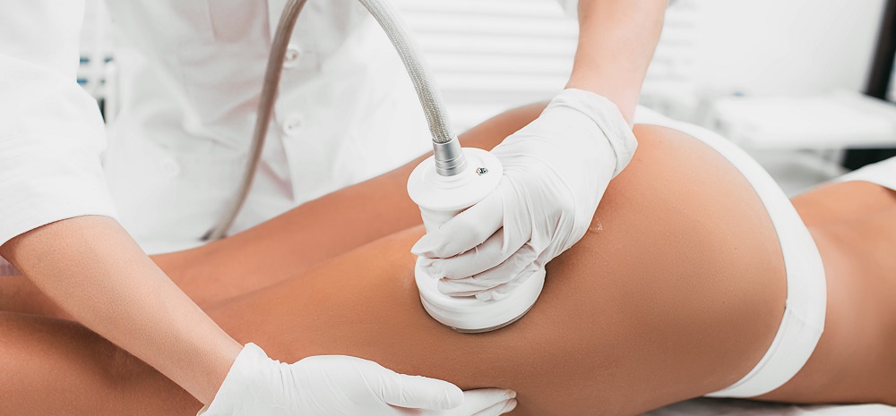 Best Treatments for Removing Cellulite