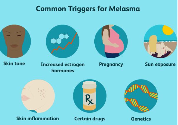 What Are The Causes Of Melasma?