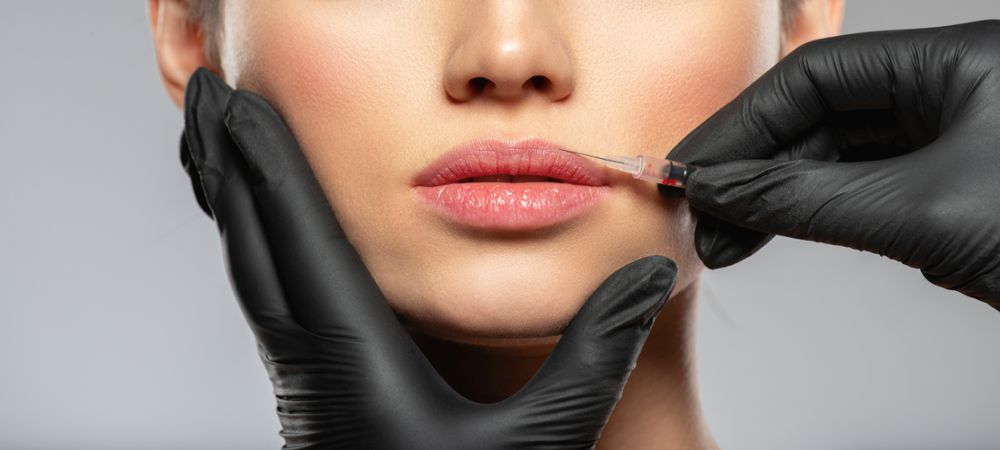 botox before after