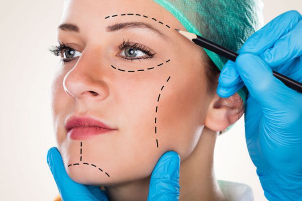 need facelift