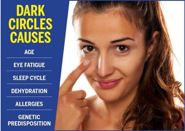 Dark Circles causes