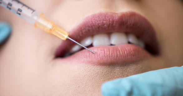 Lip Injections