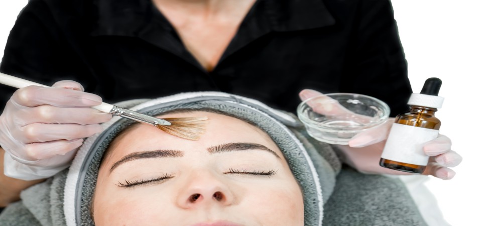 chemical peel banner