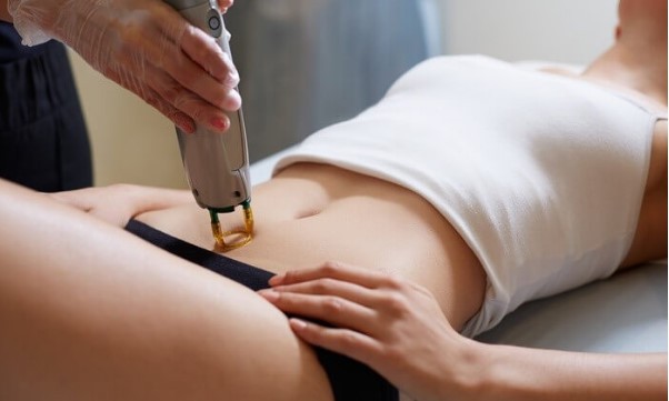 Laser hair removal machine