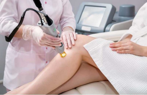 Laser hair removal