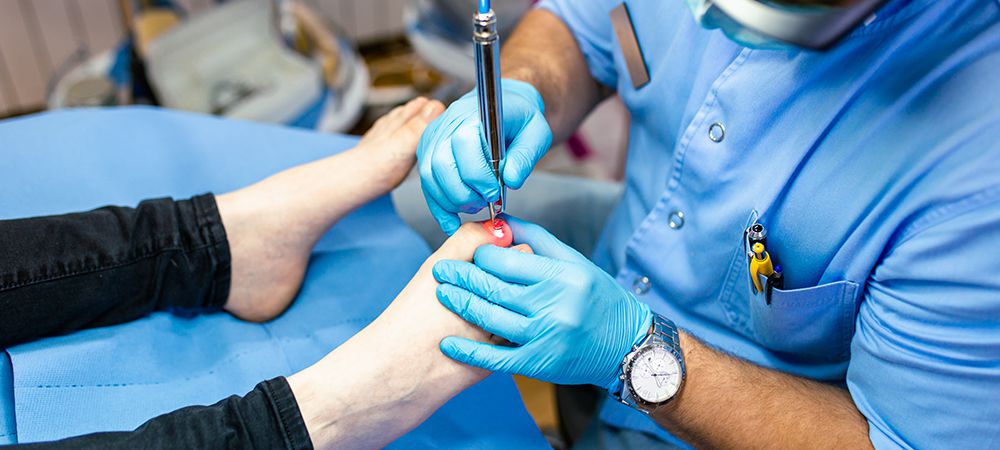 laser therapy for toenail fungus cost in toronto