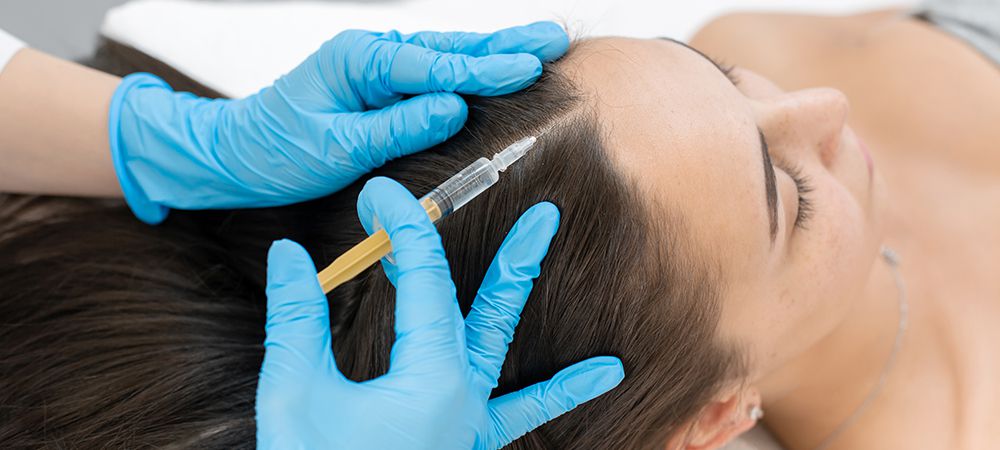 prp hair treatment