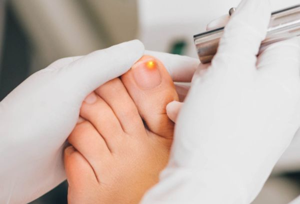 what is toenail fungus