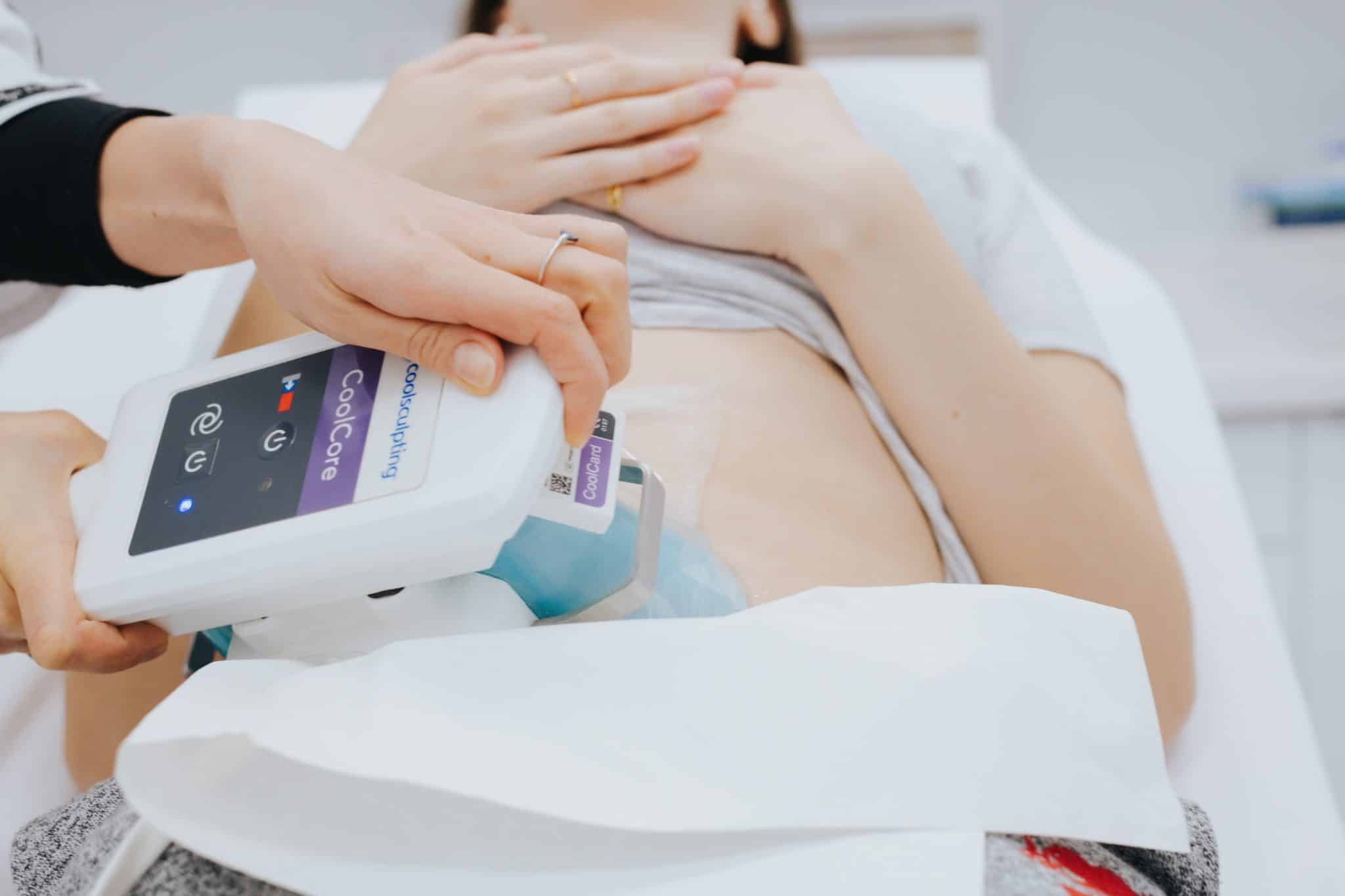 Coolsculpting treatment at Canada Medlaser