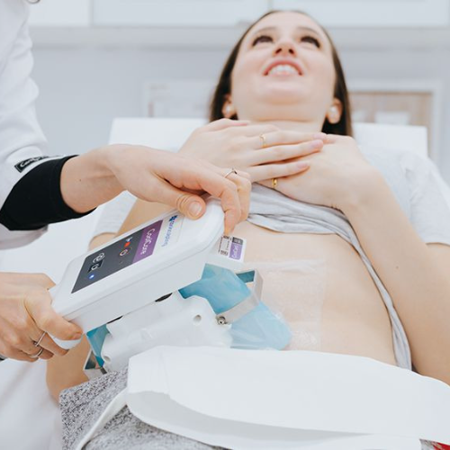 Coolsculpting treatment done at Canada Medlaser Clinic