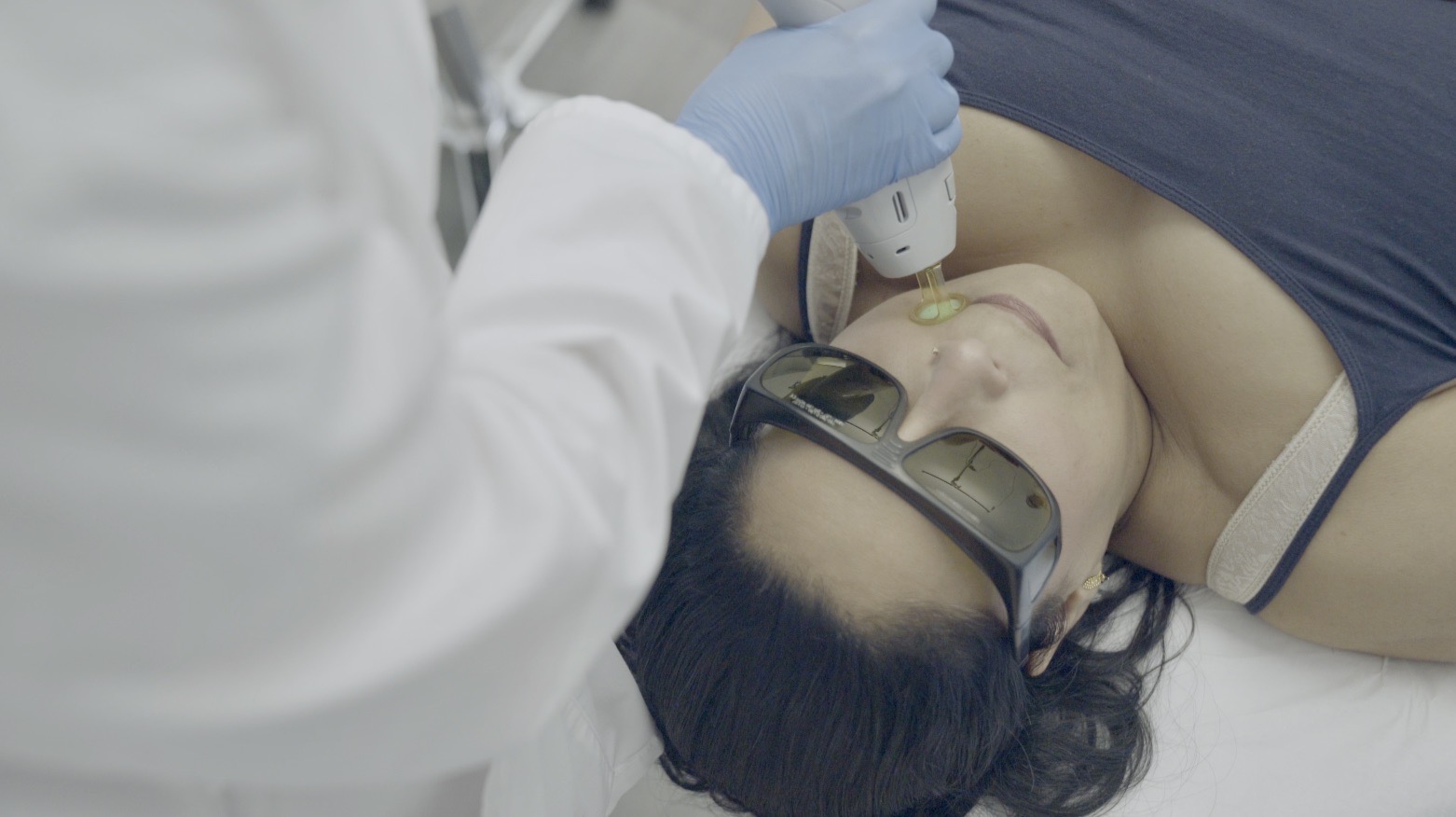 Facial Laser Hair Removal Procedure at Canada MedLaser Clinics.