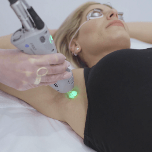 Laser hair removal treatment at Canada Medlaser