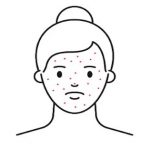 prp-skin-rejuvenation