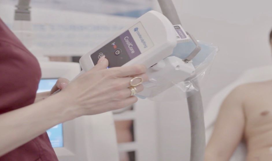 Coolsculpting assessment at Canada MedLaser