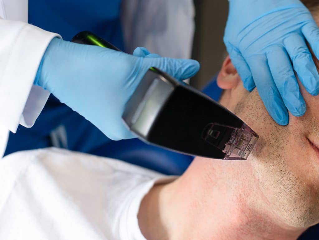 Morpheus8 Treatment