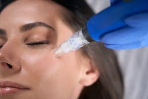 This is a microneedling blog image