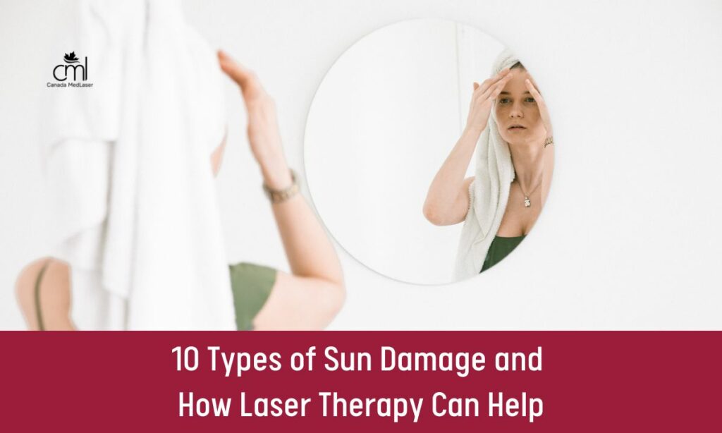 Types of Sun Damage and How Laser Therapy Can Help