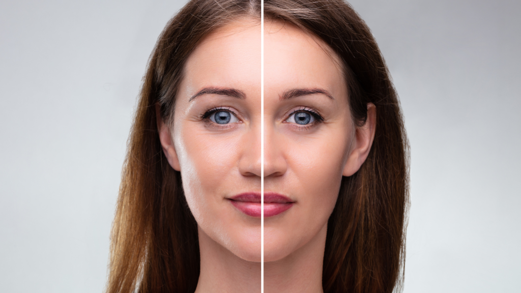 The Power of Prevention: How Early Aesthetic Interventions Can Slow Aging