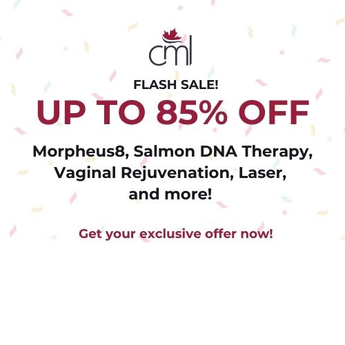 Flash Sale