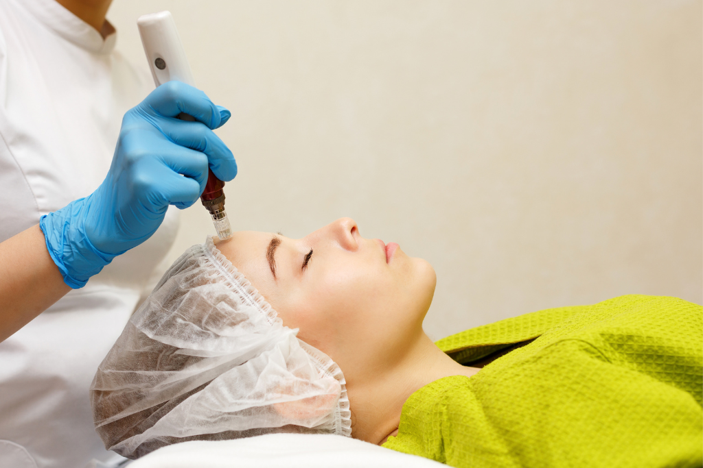 Microneedling Treatment in Mississauga blog image