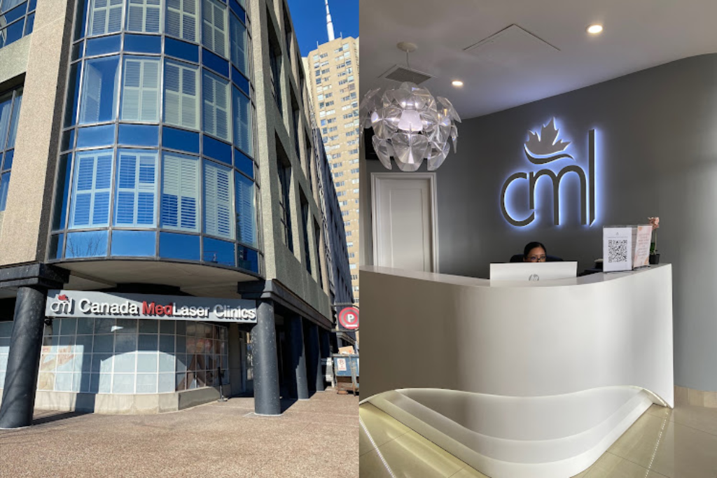 CML Franchise blog image