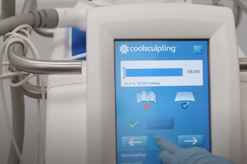 This is a coolsculpting blog image
