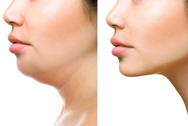 Part of face, woman with the double and perfect chin Part of face, woman with the double and perfect chin isolated on white background Beauty concept.