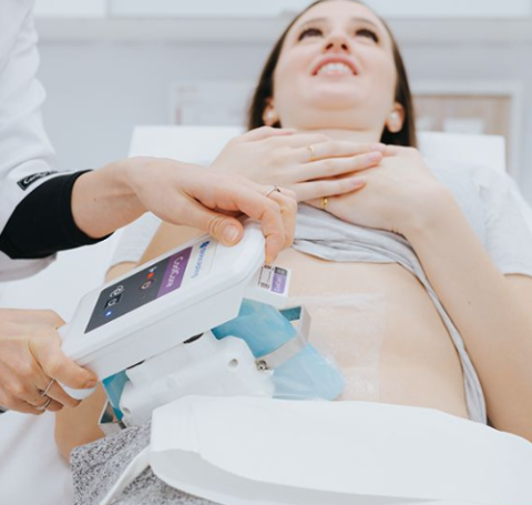 Coolsculpting | Graphic 1 Coolsculpting treatment done at Canada Medlaser Clinic