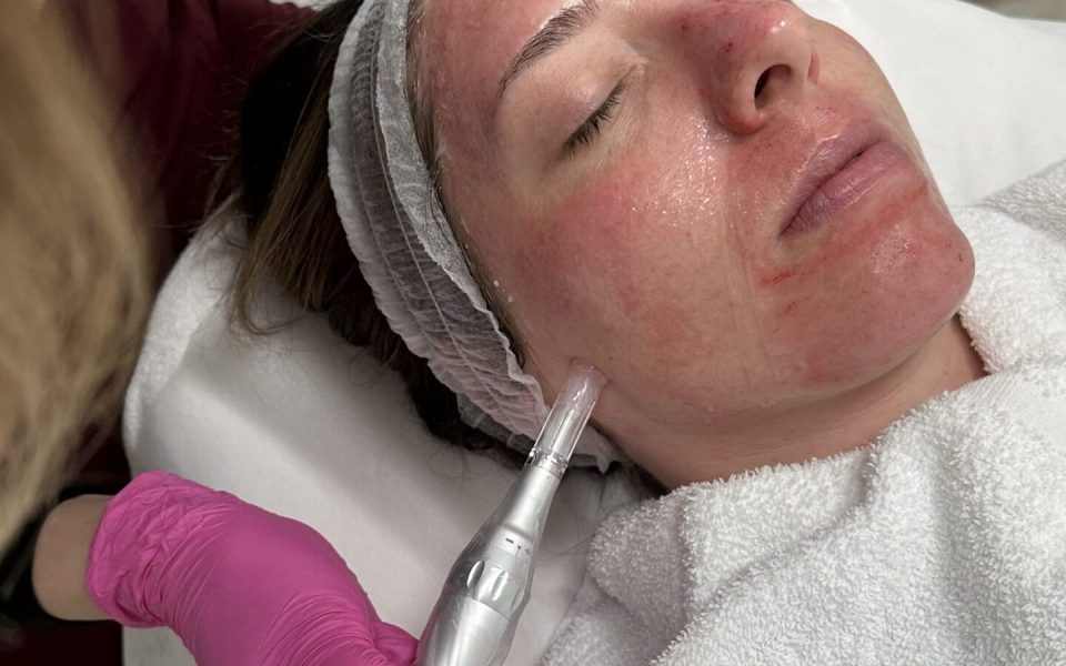Facial Salmon DNA Facial Treatment
