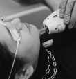 Laser Hair Removal